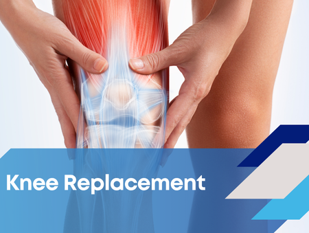 Mark Beasley Knee Replacement Resources